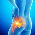 Understanding Arthritis: The Complete Guide to EBOO Clinic's Healthcare Solutions