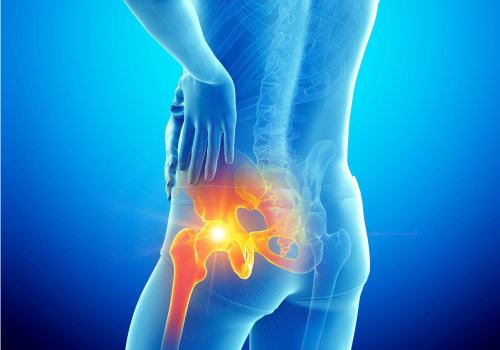 Understanding Arthritis: The Complete Guide to EBOO Clinic's Healthcare Solutions